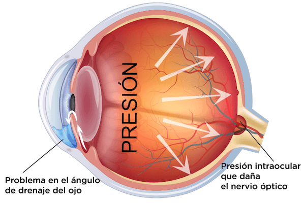 Clinica Oftalmologica en La Roma Norte Oftalmologos en Mexico Especialistas en Glaucoma v001 compressor