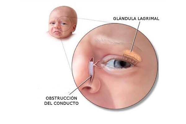 Clinica Oftalmologica en Roma Norte Oftalmologos en Mexico Especialistas en Diagnostico y Tratamiento de Obstruccion de Via Lagrimal v001